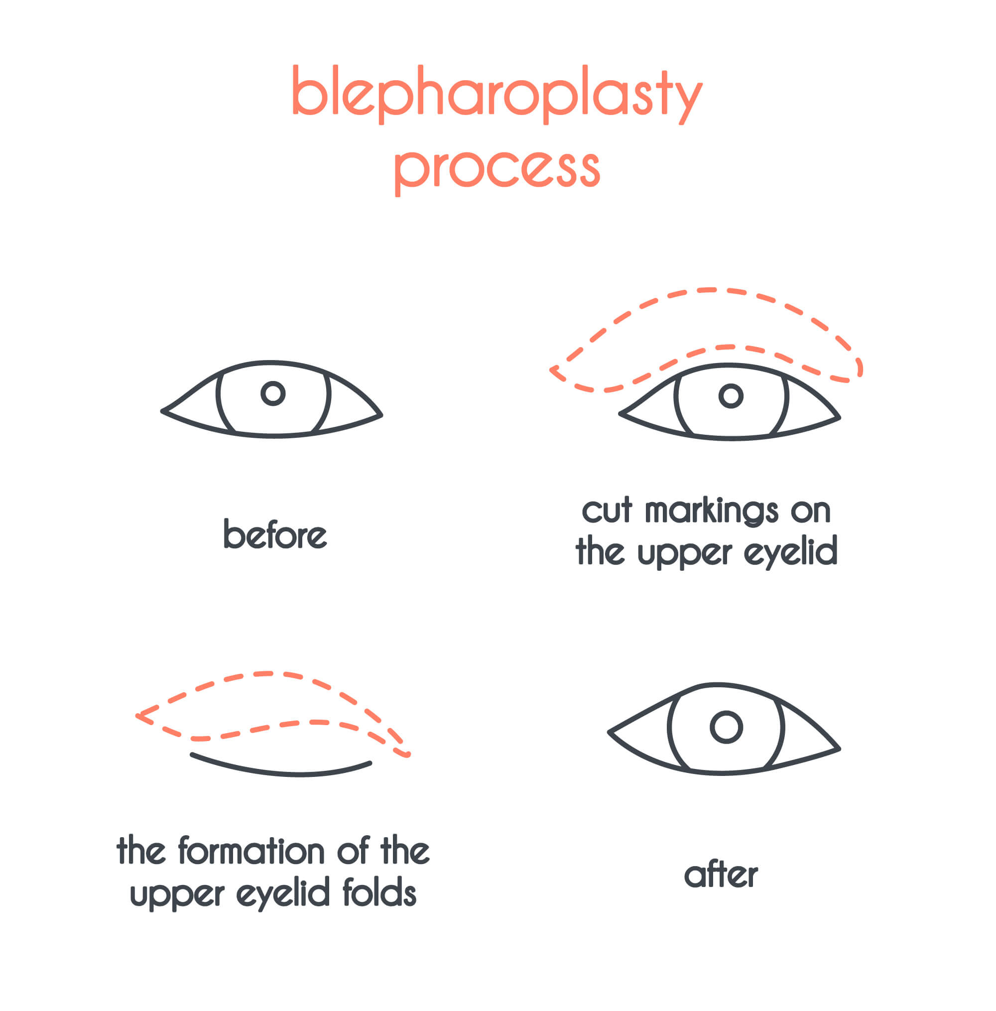 Oculoplastic Surgeon CT | Blepharoplasty Glastonbury