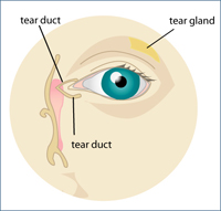 Dry Eye Syndrome Diagram