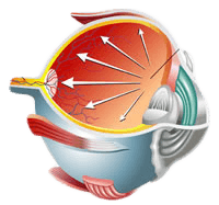 Glaucoma Treatment Diagram