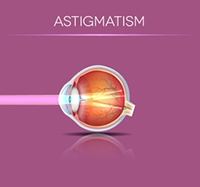 Astigmatism Correction Diagram