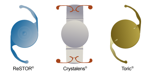 Intraocular Lens Implant Examples